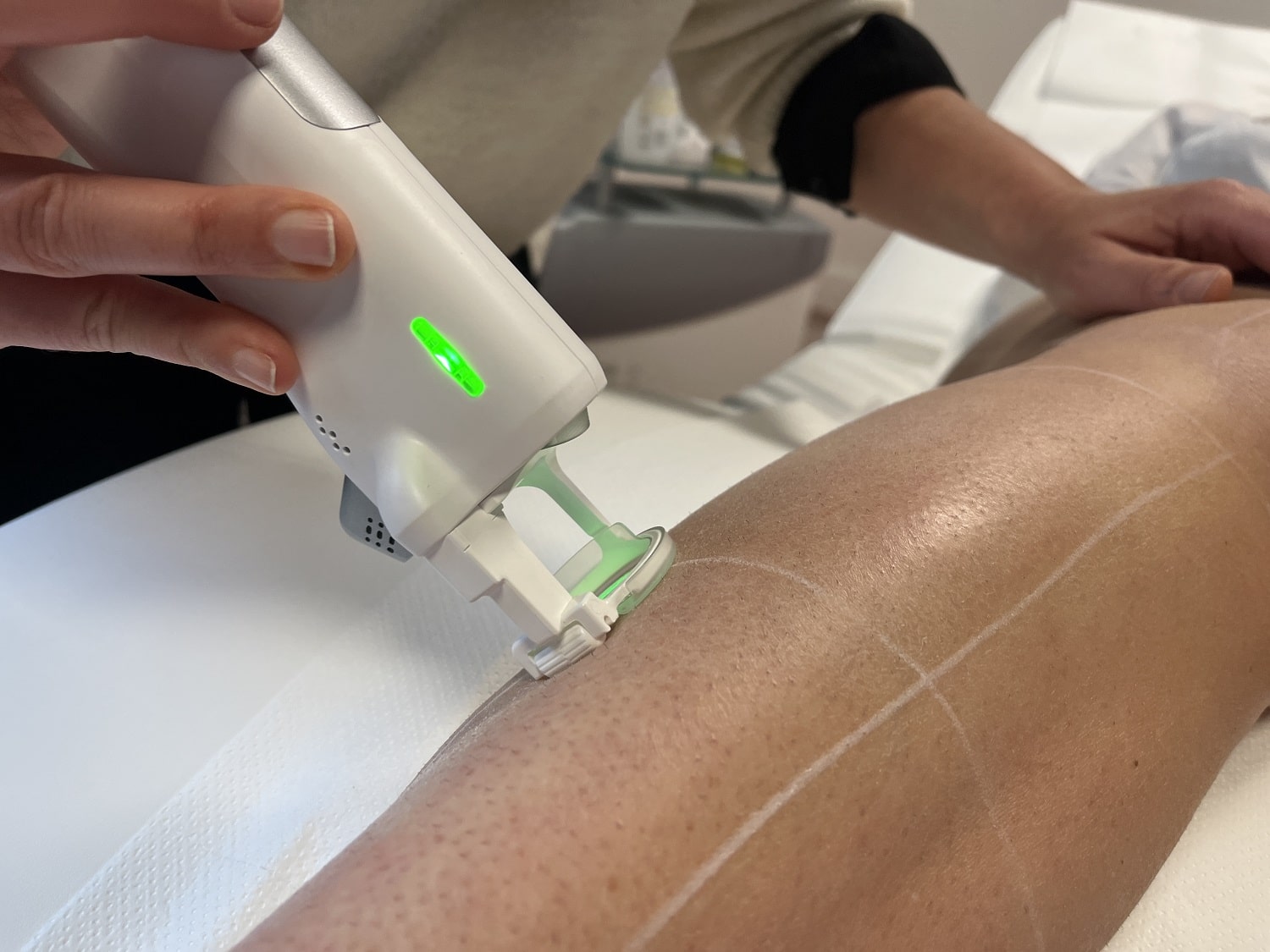 Epilation Laser Haute Savoie